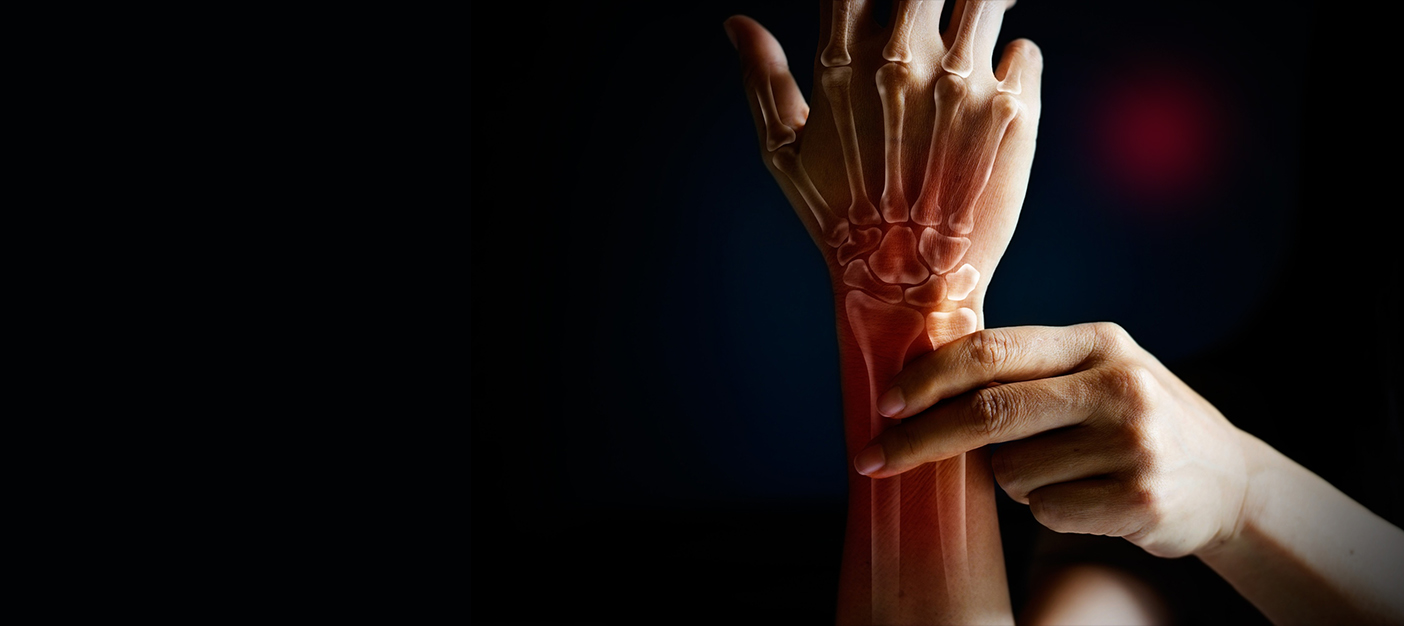 Top Wrist Injury Treatment in Dwarka – Accurate Diagnosis & Quick Recovery